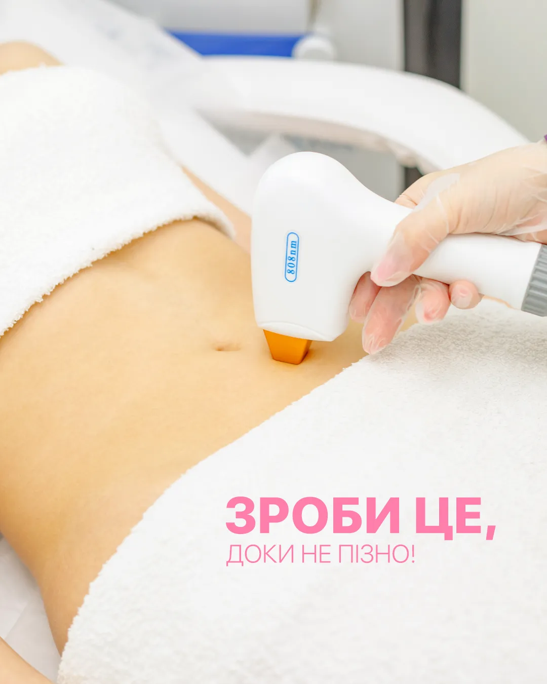 сезон лазерної епіляції